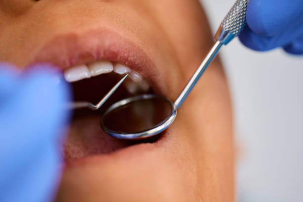 image 1 close-up shot of a person's mouth during dental examination