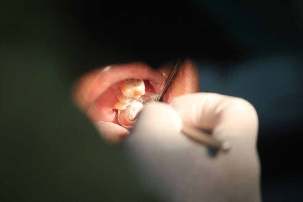 cavity 6