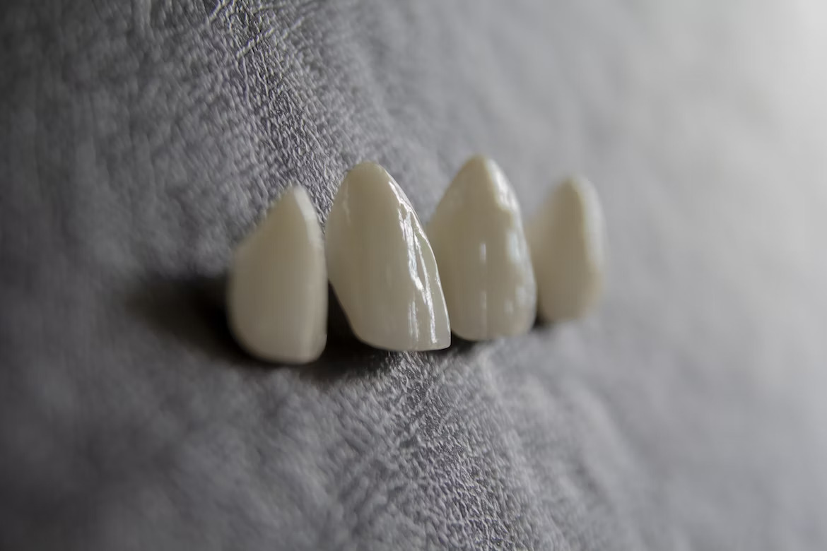 thin resin shells for dental veneers on a dark surface