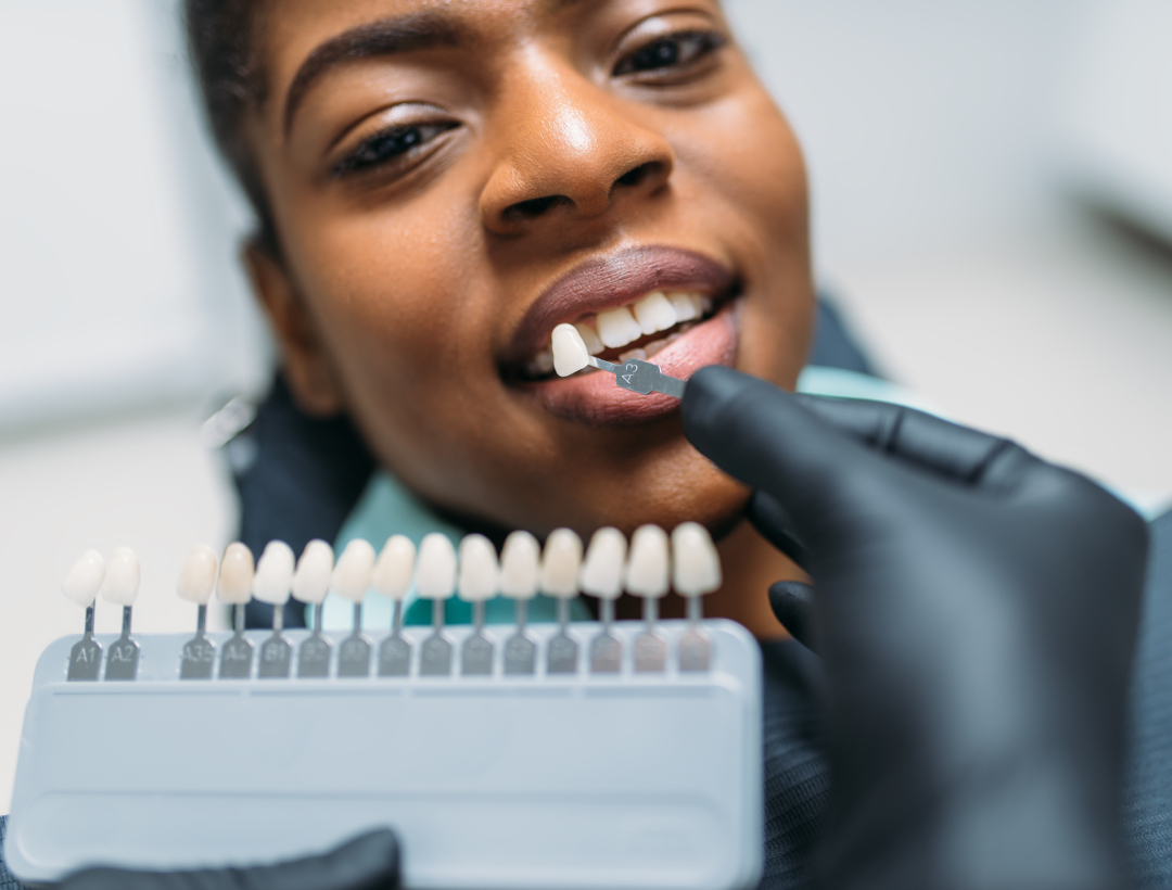 Dental Veneers dental veneers