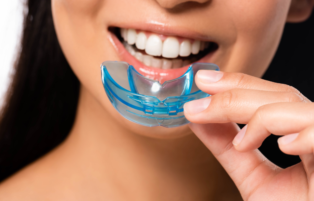 Mouth Guards 3 mouth guards (3)