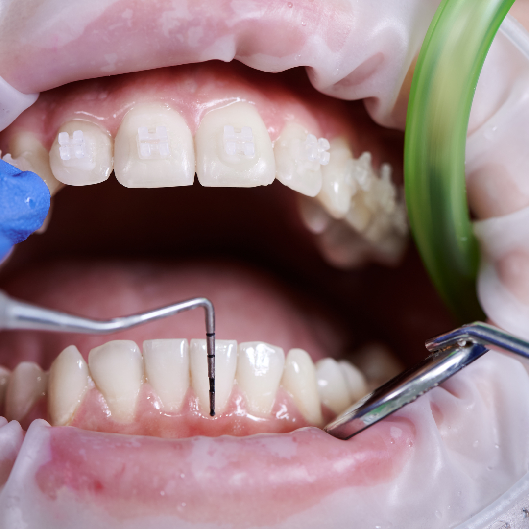Restorative Dentistry 1 restorative dentistry