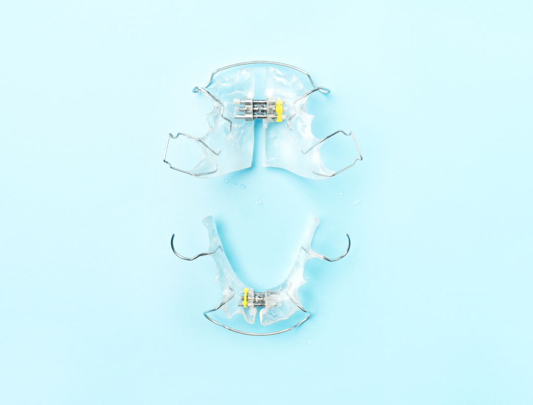 Retainers 1 retainers