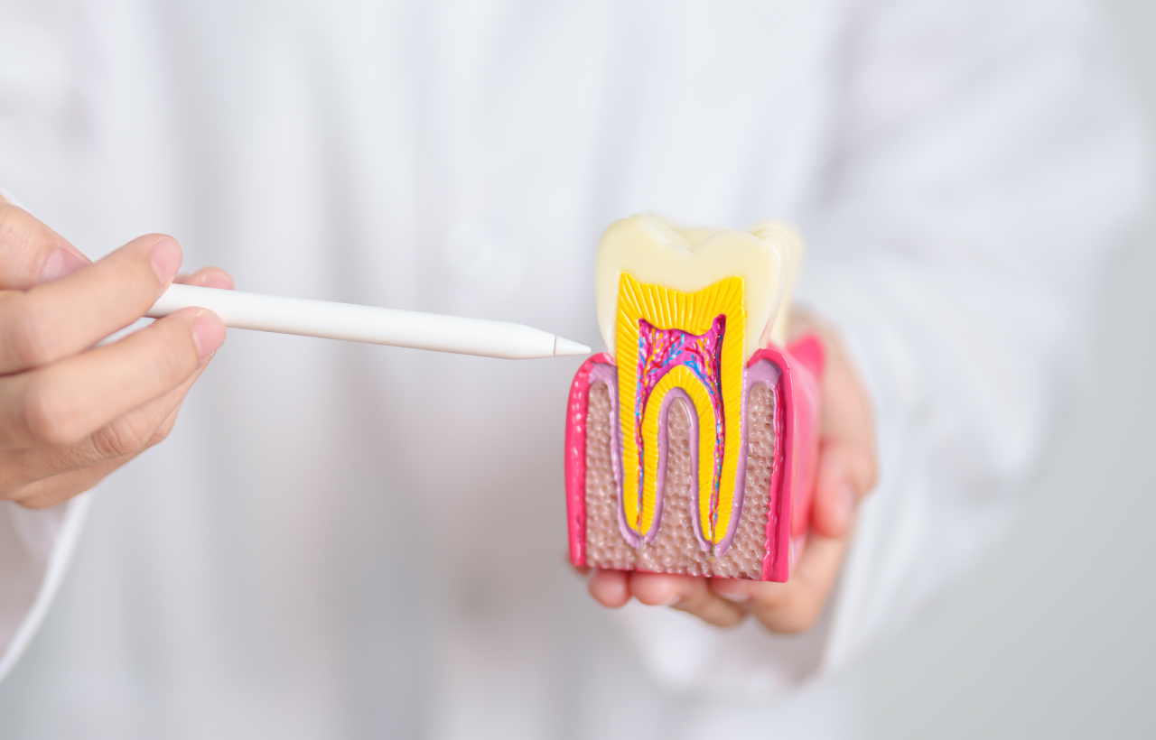 Root Canal Therapy root canal therapy