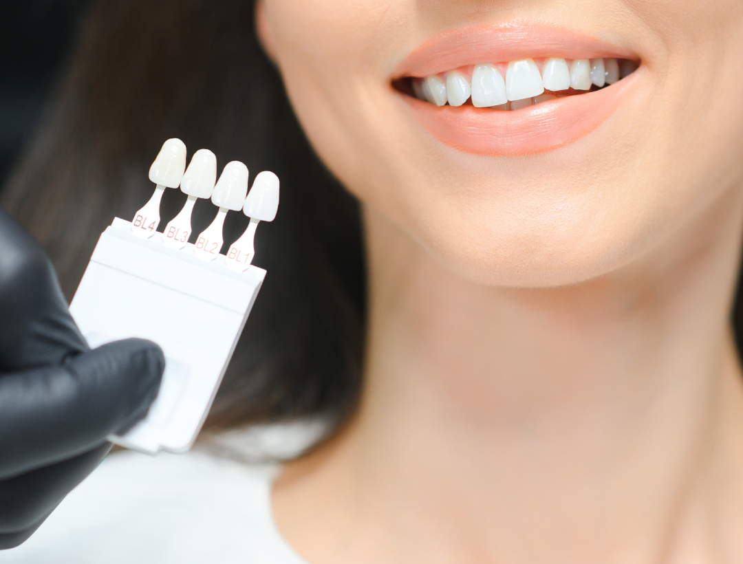 Teeth Whitening 3 teeth whitening