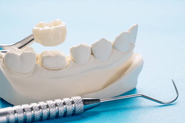 a dental model with a dental scaler