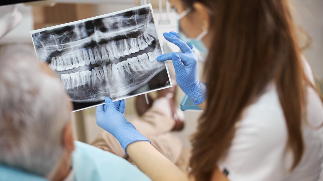 How Digital X-Rays Help Reduce Radiation Exposure